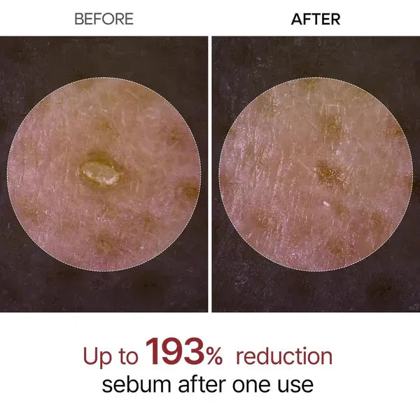 Dr. Melaxin Duo Rice Peel Ampoule