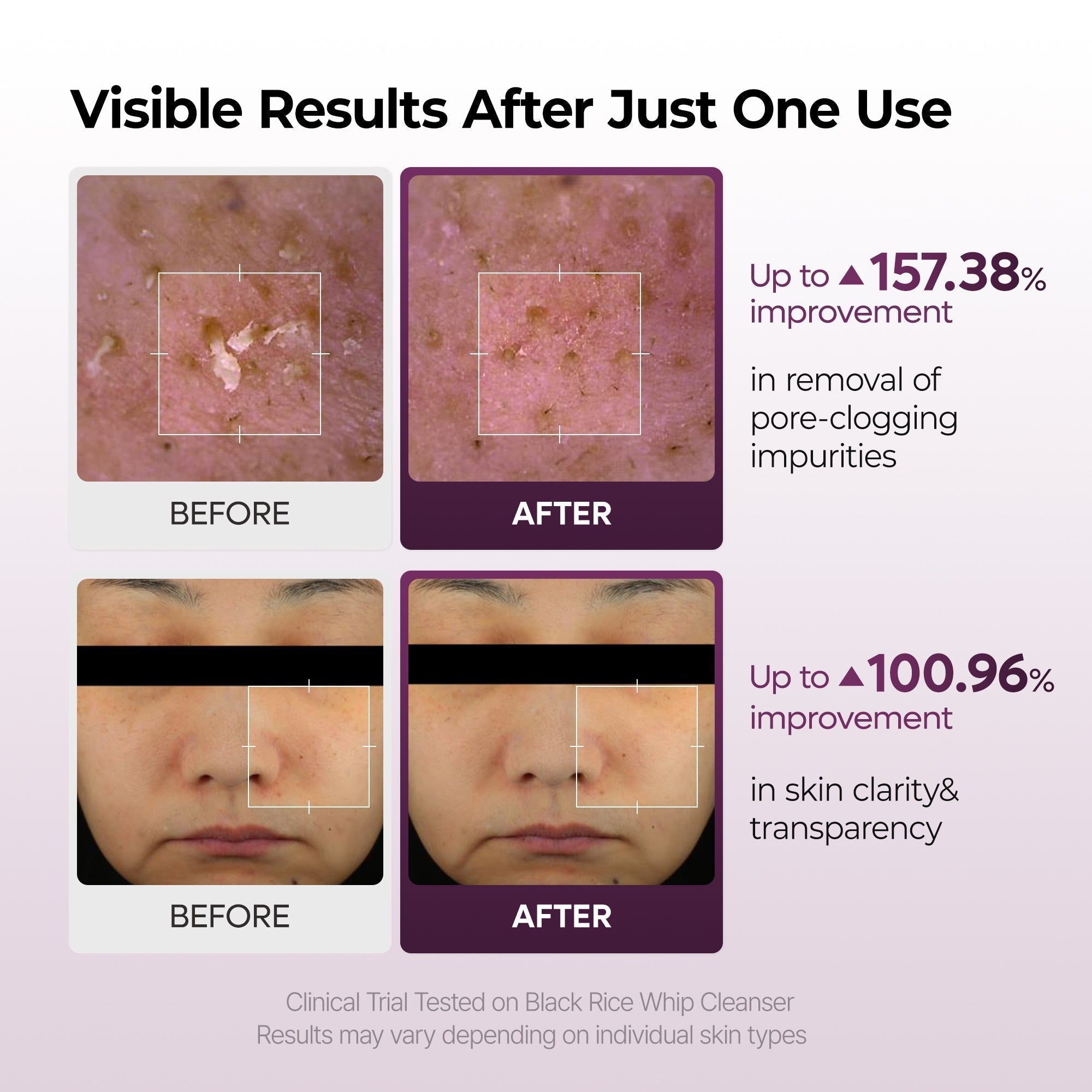 Peel Shot Glow Routine - Éclat & Uniformité