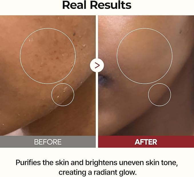 Dr. Melaxin Duo Rice Peel Ampoule