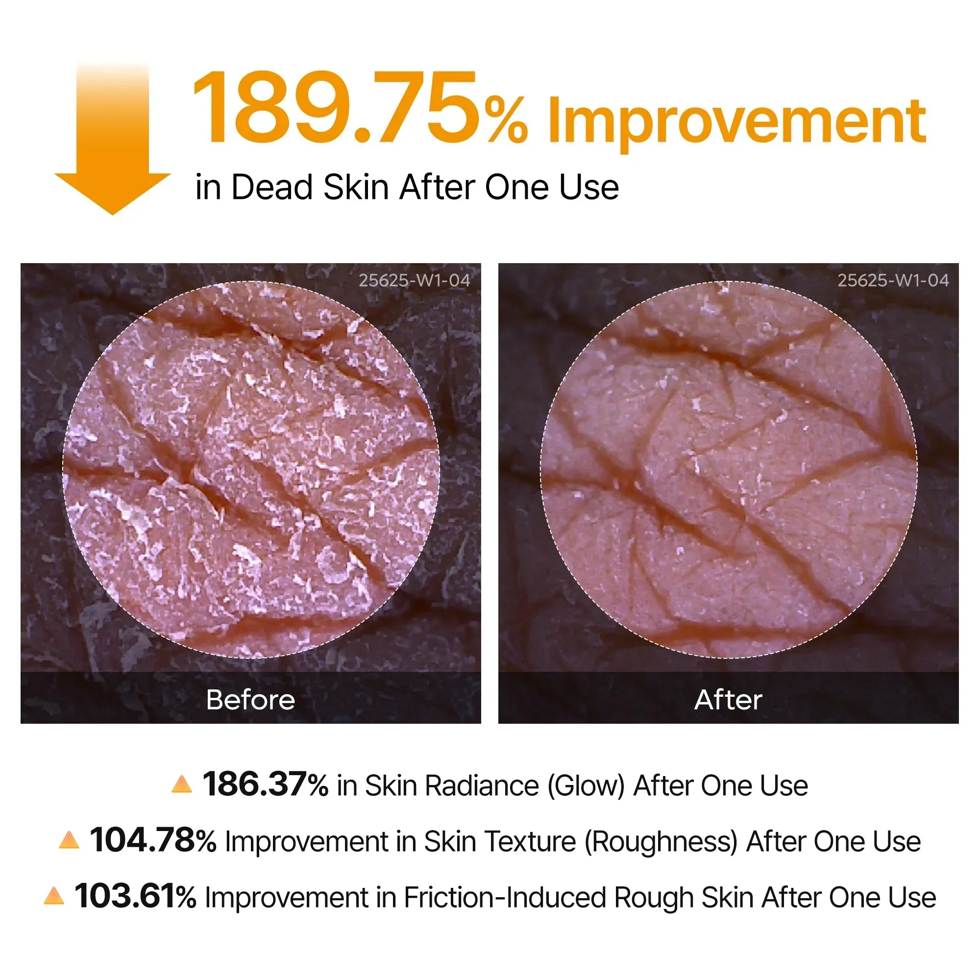 Peel Shot Complete Care Set